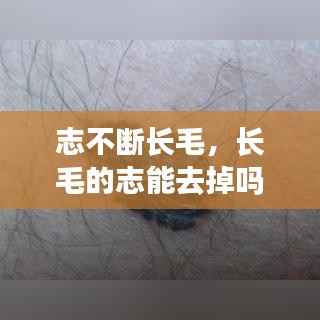 志不断长毛，长毛的志能去掉吗? 