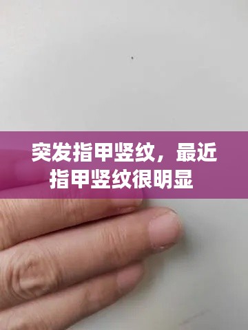 突发指甲竖纹,最近指甲竖纹很明显